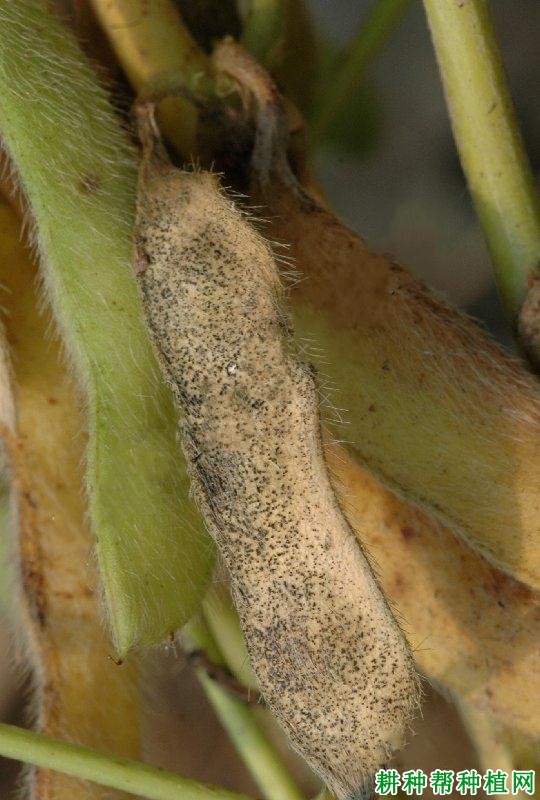 种植大豆如何防治大豆荚枯病？